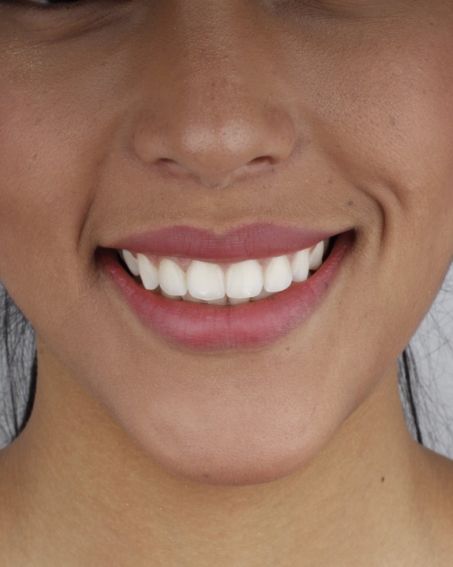 Sonrisa de una paciente de Servicios Dentales Hispanos